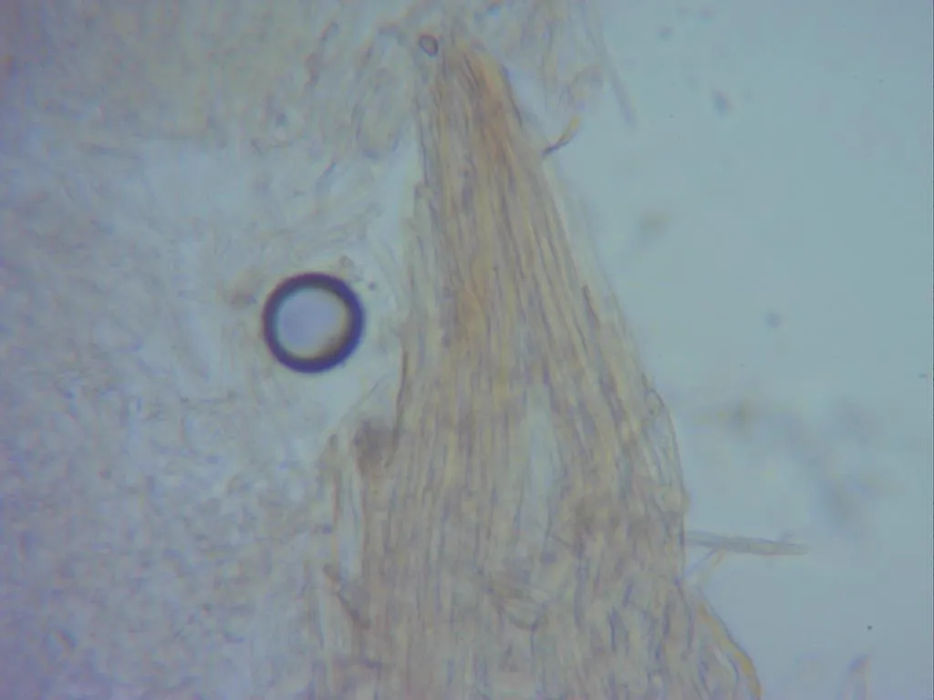 Microscopía de Panus neostrigosus - 10 - Escamas sombrero x 400